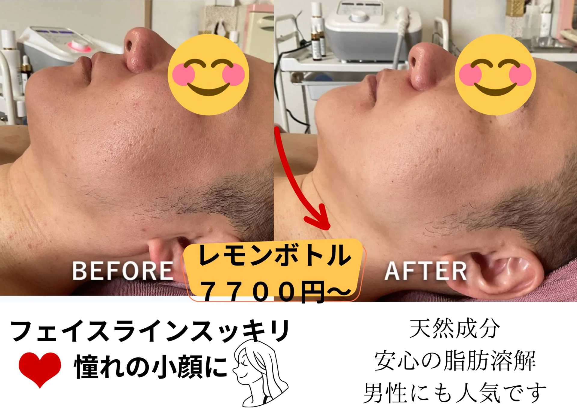 大人気 レモンボトル